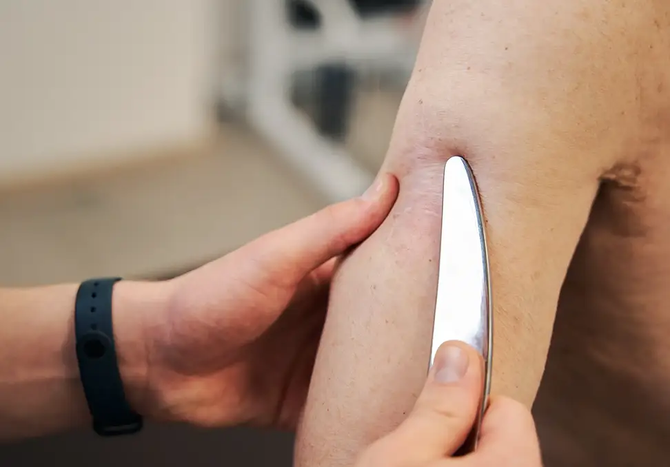 Person receiving IASTM treatment with stainless steel tool on elbow, demonstrating soft tissue mobilization for injury recovery and mobility improvement.